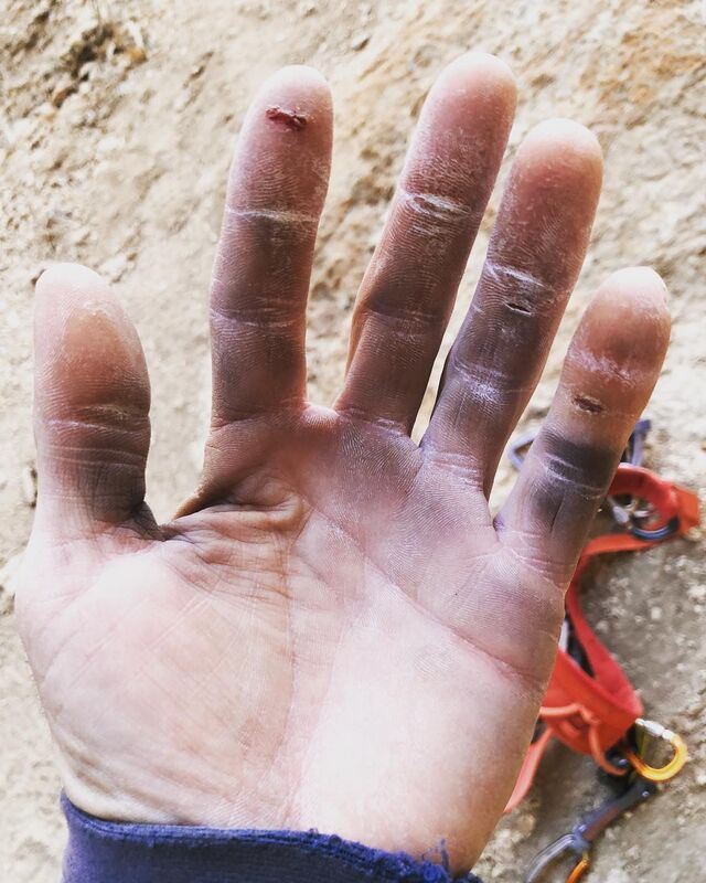 Chris Sharma partilha uma fotografia das mãos após uma escalada no Instagram