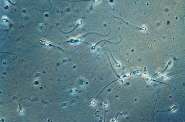 O plástico pode estar a afetar a qualidade do esperma, avisa estudo