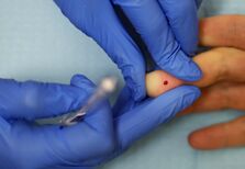 Alzheimer: novo teste diagnostica 15 anos antes dos sintomas